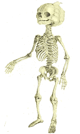 An image for Then A Skeleton Popped Out